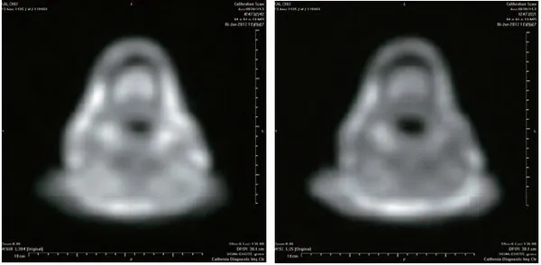 开初仁波且修摊尸拙火定 体温高达摄氏92 度