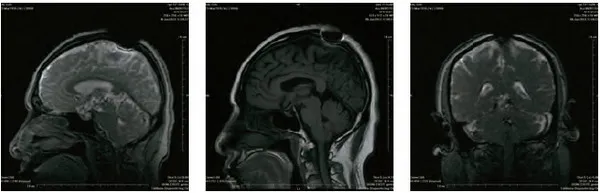开初仁波且修摊尸拙火定 体温高达摄氏92 度