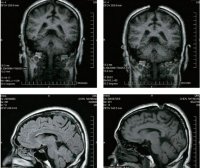 开顶意味著什么?