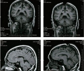 开顶意味著什么?
