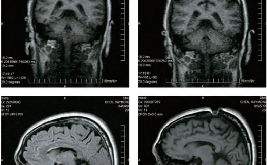 开顶意味著什么?