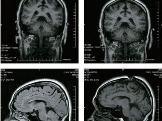开顶意味著什么？